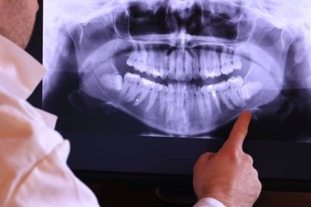 Best Broken or Chipped Tooth Repair in Wenatchee, WA